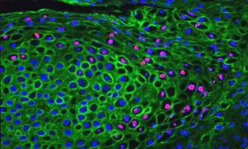 Immunohistochemistry