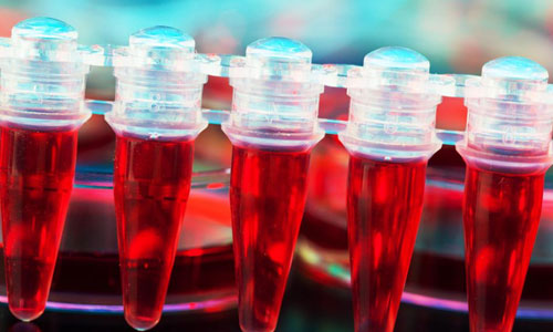 Serology
